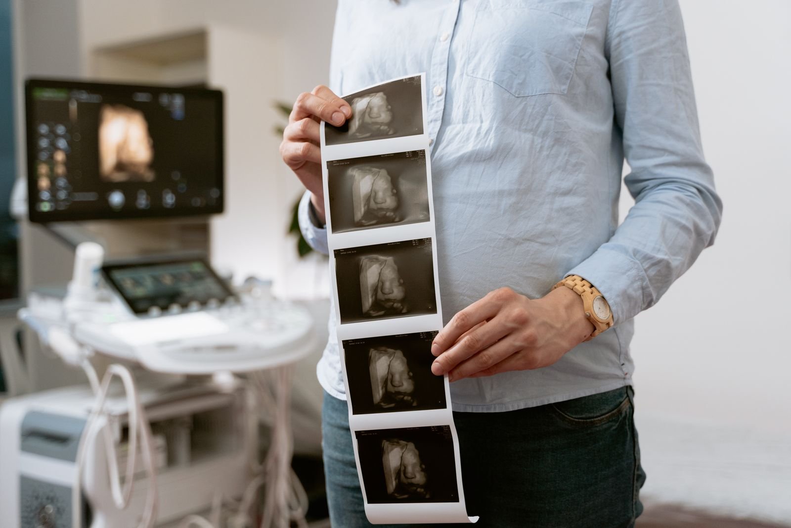 Ocular Ultrasound for Animals